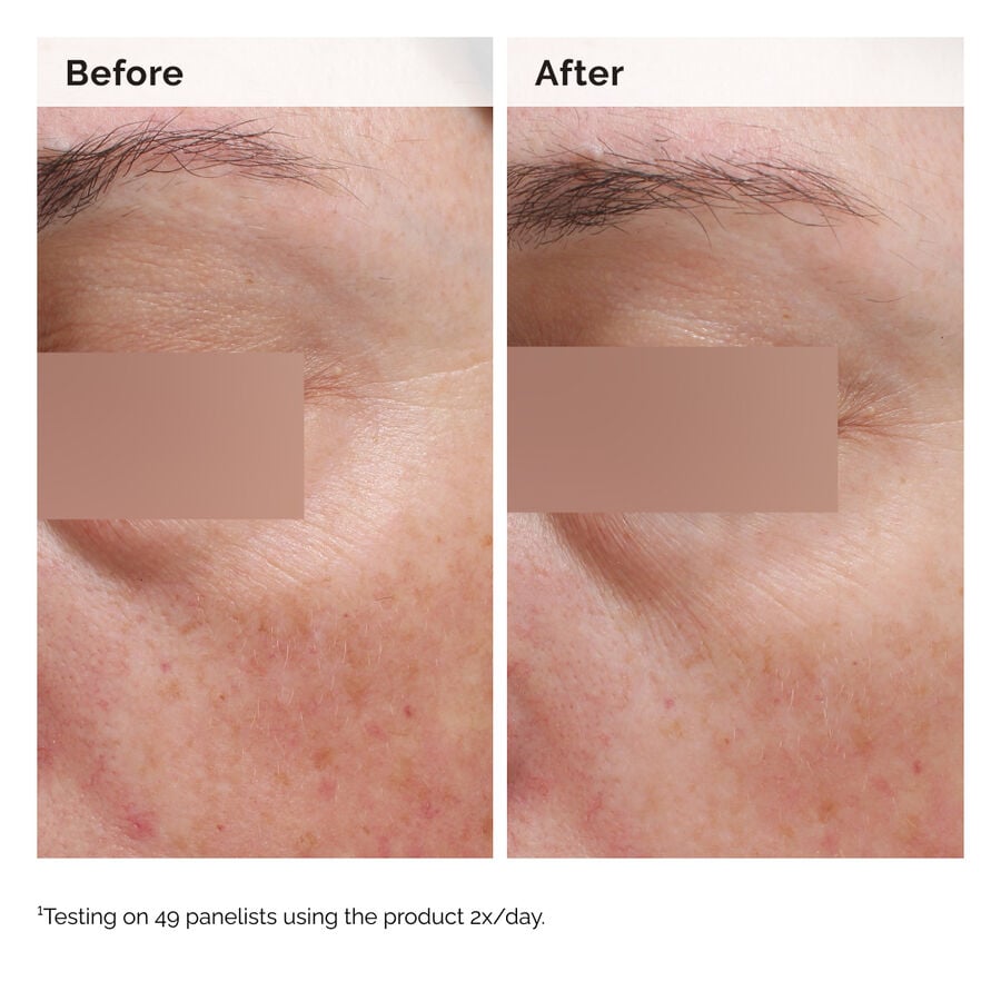 niacinamide-5-face-and-body-emulsion-l3 2024-08-23-ORD-Nia-5pct-Face-Body-B-A-Elasticity-Global-02-1x1.jpg
