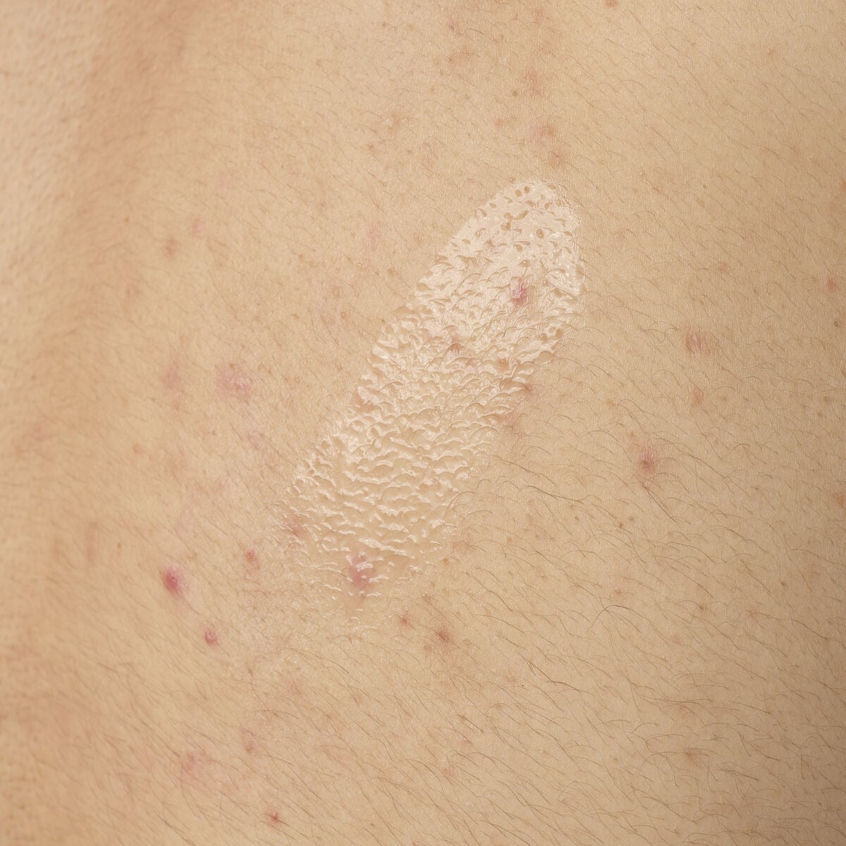 salicylic-acid-0-5-body-serum-z0 ORD-salicylic-acid-05-body-240ml-application.jpg