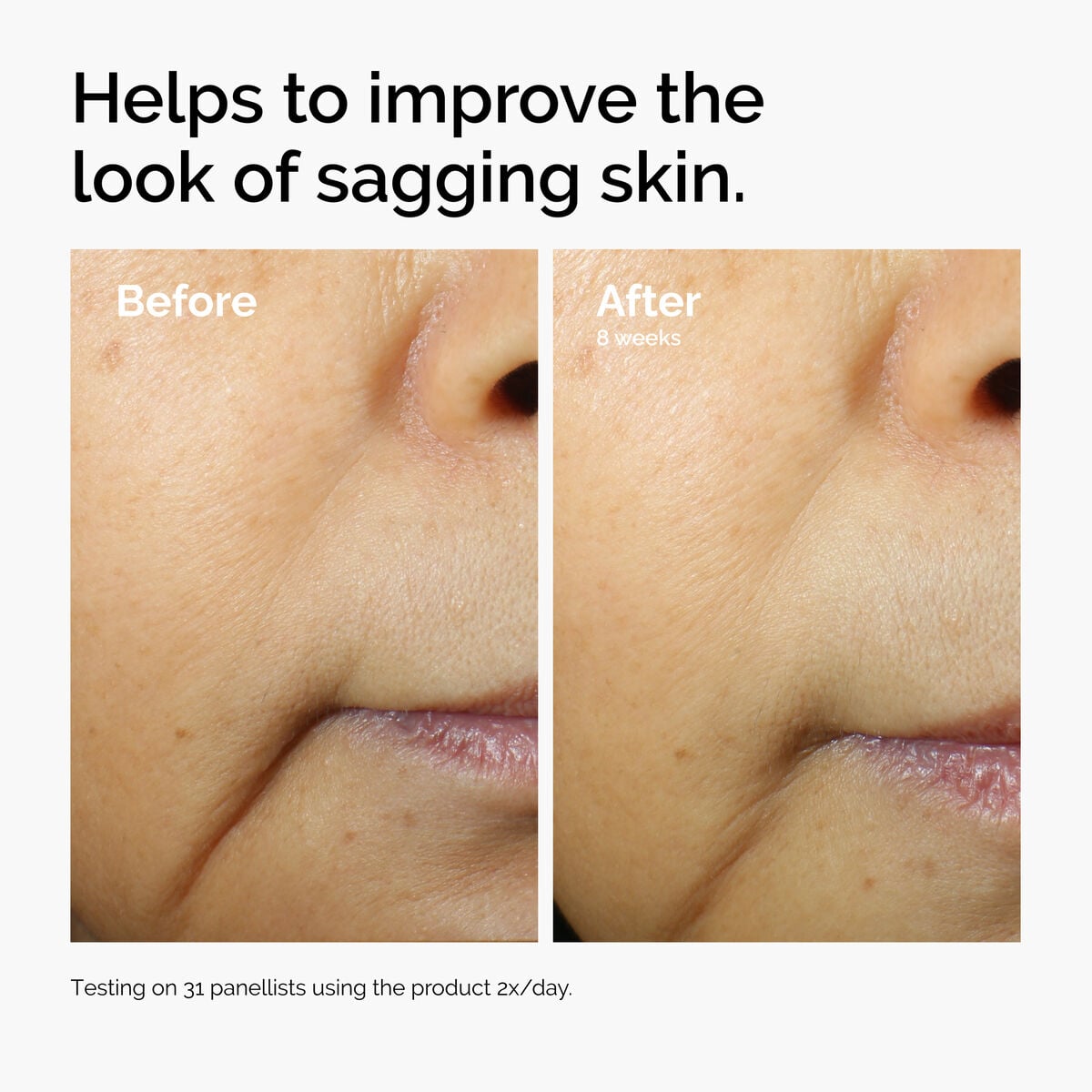 caffeine-3-escin-1-face-serum-z6 ord-caffeine-3pct-escin-1pct-face-serum-before-after-sagging.jpg