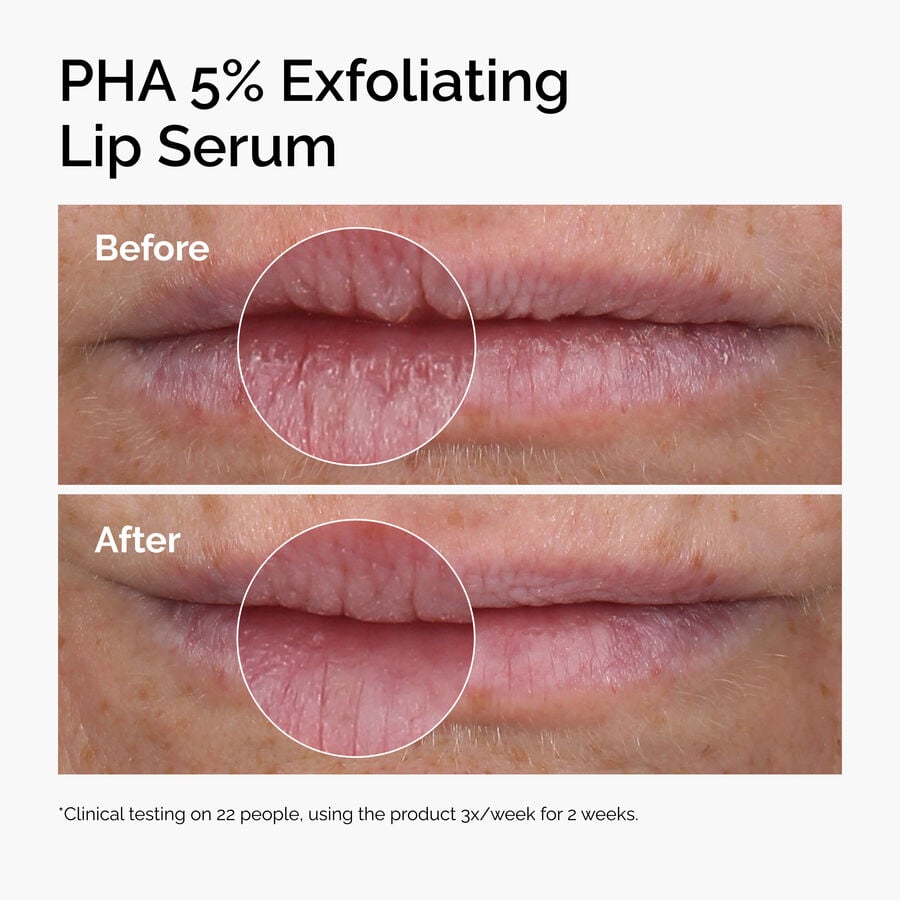 pha-5-exfoliating-lip-serum-x6 ord-pha-5pct-lip-exfoliating-serum-before-after.jpg