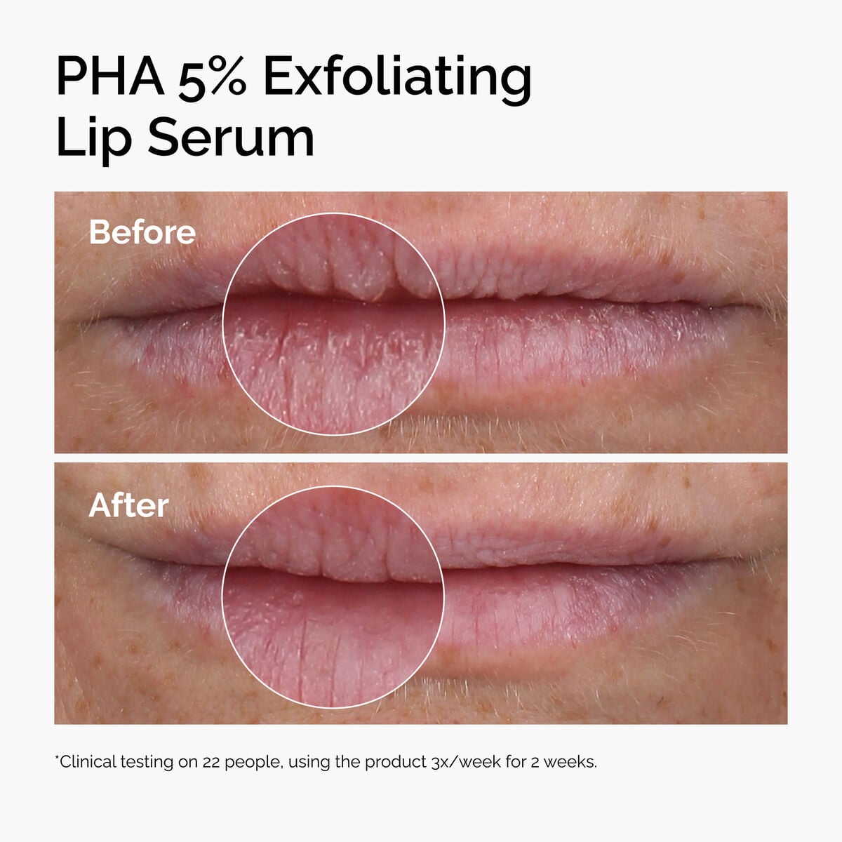 pha-5-exfoliating-lip-serum-b3 ord-pha-5pct-lip-exfoliating-serum-before-after.jpg